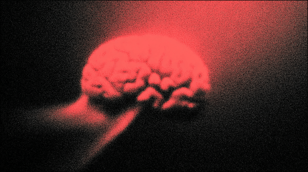 Open-Source AI Tool by Yandex Detects Signs of Infant Cerebral